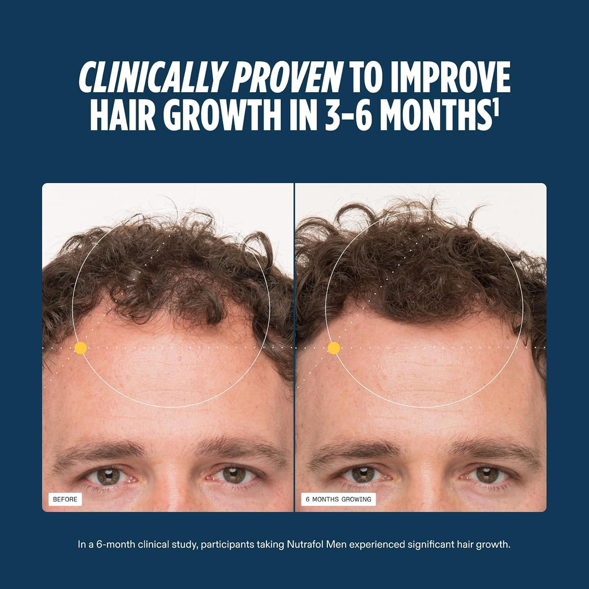 Nutrafol Men  Hair Growth Supplements